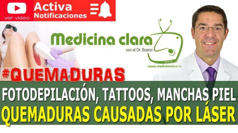 como saber si me han quemado con el láser