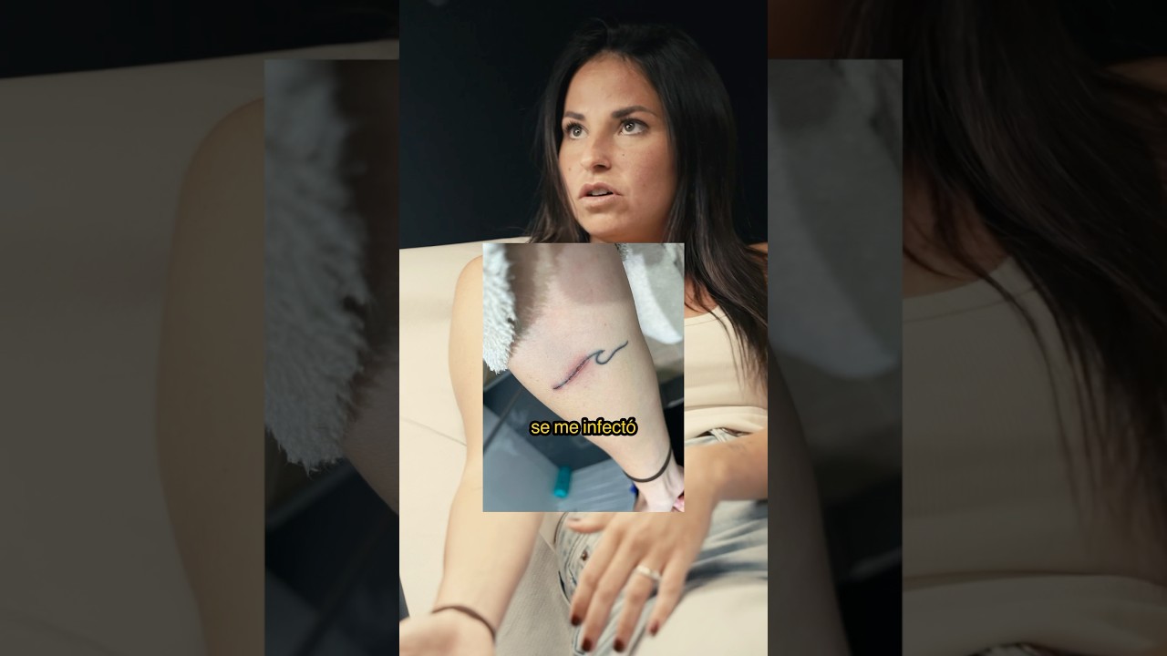 tatuaje quemado con depilación láser